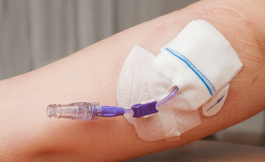 What Is PICC Line Tubing?